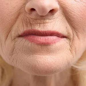 causas y remedios para evitar arrugas en los labios